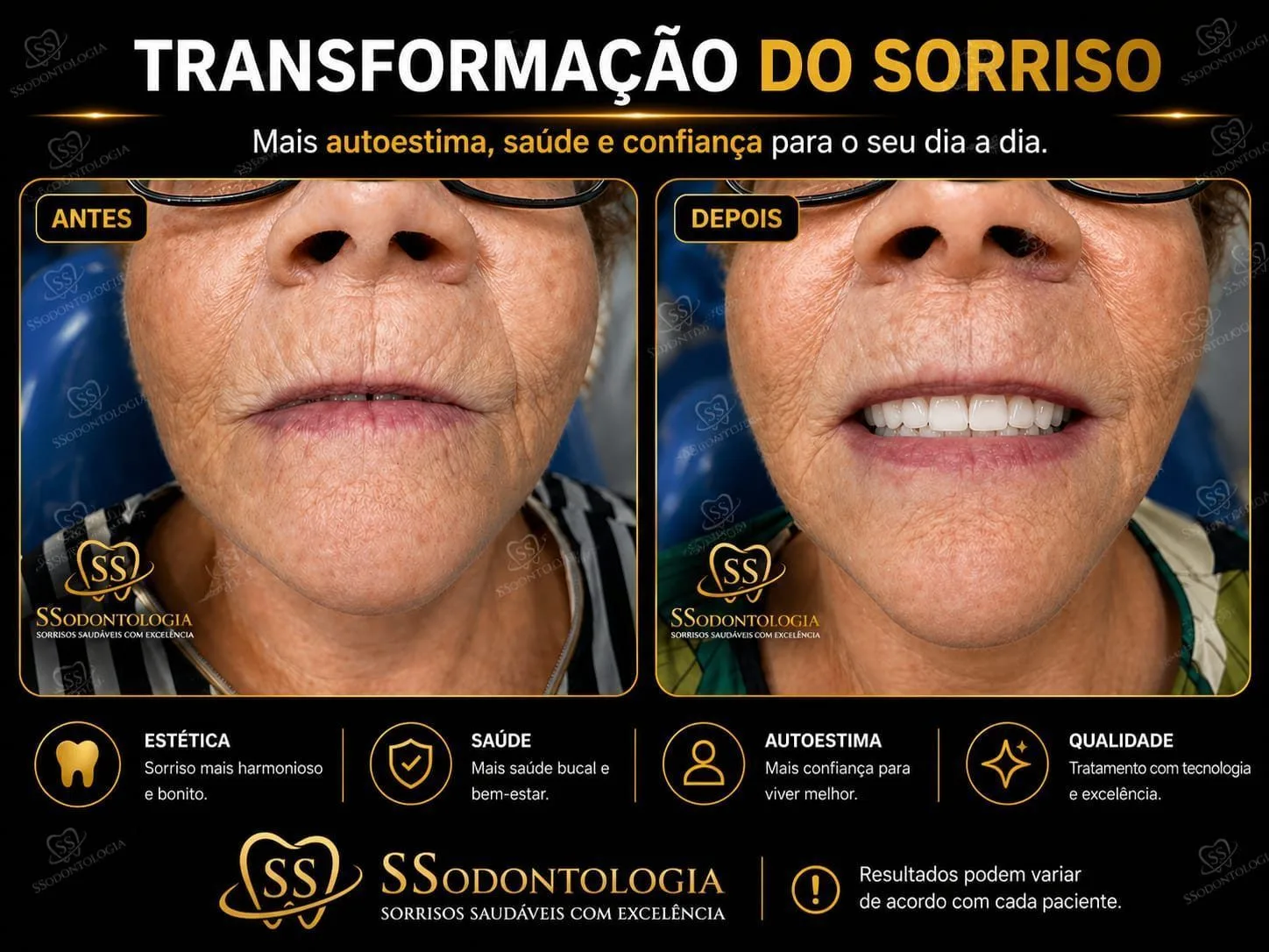 Antes e depois: Prótese Total
