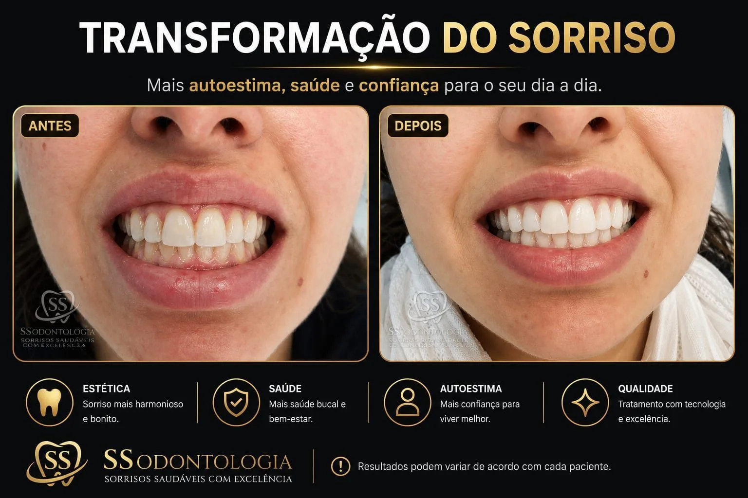 Antes e depois: Estética Dental