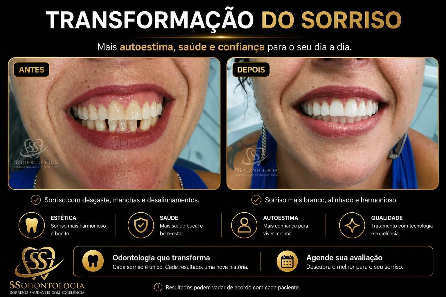 Antes e depois: Estética e Reabilitação